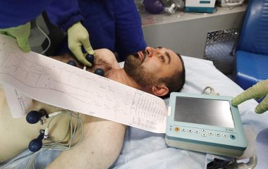 Професор кардіології назвав три ознаки інфаркту