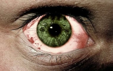 Специалисты рассказали, как избавиться от раздражения и покраснения глаз