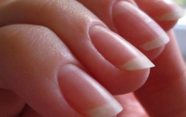 Діагноз на пальцях. Які хвороби можна дізнатися за станом нігтів