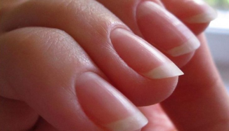 Діагноз на пальцях. Які хвороби можна дізнатися за станом нігтів