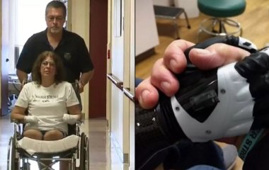 Жінка втратила всі кінцівки після 