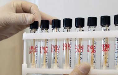 Сонячний ультрафіолет знищує частки коронавірусу за лічені хвилини.