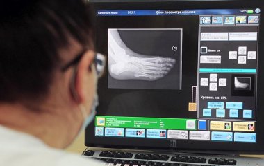Ортопеди розповіли про способи уникнути плоскостопості