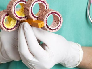 Медики рассказали, как вывести из организма свободные радикалы