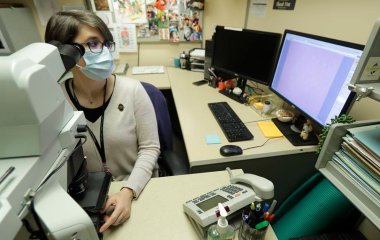 У кишечнику м'ясоїдів знайшли бактерії, пов'язані з підвищеним ризиком атеросклерозу