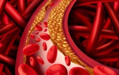 Від тромбів і когнітивних функцій: названий простий, але корисний чай