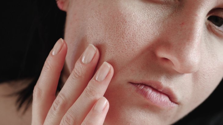Нутрициолог рассказала, какие продукты помогут улучшить кожу лица