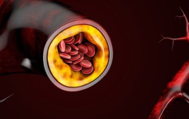Исследователи назвали продукт, помогающий снизить уровень холестерина так же эффективно, как и статины