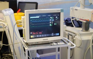 Лікар попередила про ризик інсульту та інфаркту через пальмову олію