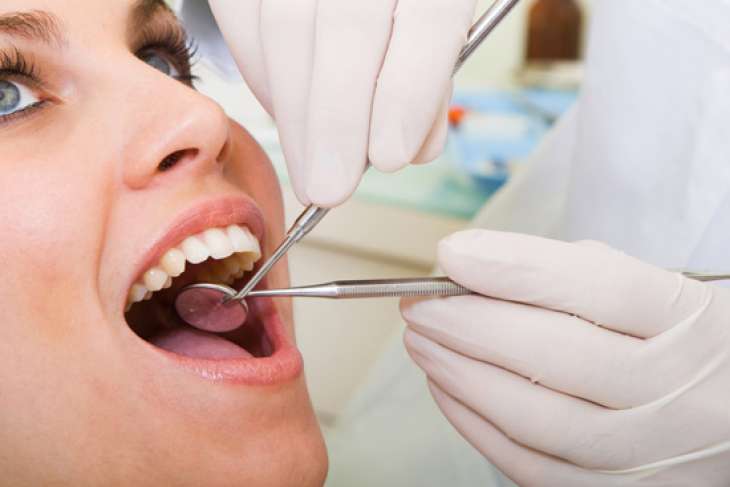 Как безопасно избавиться от зубного камня