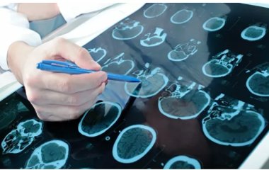 Вчені відкрили дев'ять генів, які керують розмірами мозку та черепа