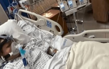 Жінка втратила всі кінцівки після вживання недосмаженої риби: що сталося
