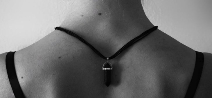 Онколог розповів, як відрізнити меланому від звичайної родимки