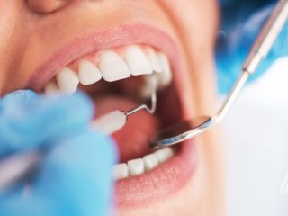 Рак рота часто починається з непомітного симптому: на що звернути увагу