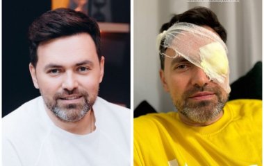 Тимур Мирошниченко показался с повязкой на глазу и испугал фанов видом своего лица