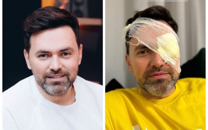 Тимур Мирошниченко показался с повязкой на глазу и испугал фанов видом своего лица