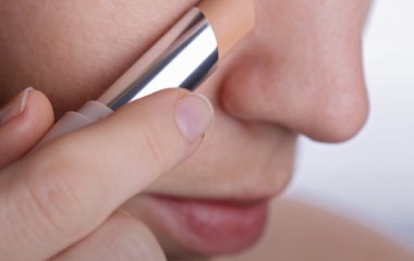 Чому з'являються синці під очима?