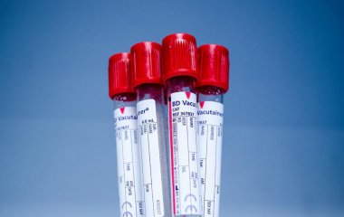 Люди с какой группой крови чаще болеют раком: ответ врача