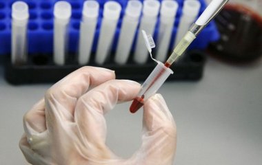 Вчені винайшли високочутливий до раку аналіз крові