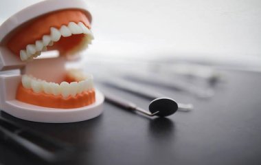 Стоматолог рассказал, как часто можно делать профессиональную чистку зубов