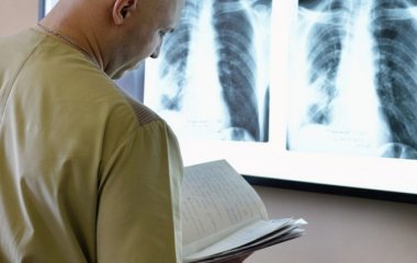 Онколог перерахував методи лікування раку легень