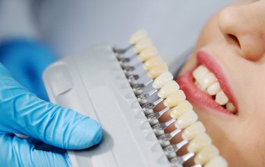 Вчені розповіли, як відбілювання впливає на здоров'я зубів