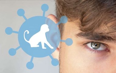 Медики назвали новые симптомы оспы обезьян