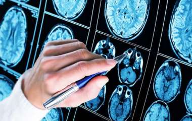 Ученые перечислили способы предотвращения старения мозга