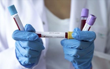 Первый пошёл: Мужчина умер через восемь минут после прививки от коронавируса