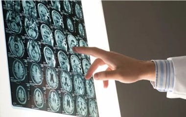 Названо категорію людей, у яких швидко розвивається рак