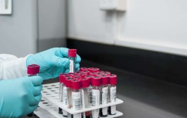 Медики назвали группу крови, обладатели которой реже всего болеют раком
