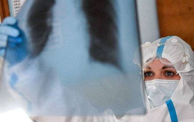 Лікар назвав способи очистити легені після коронавірусу