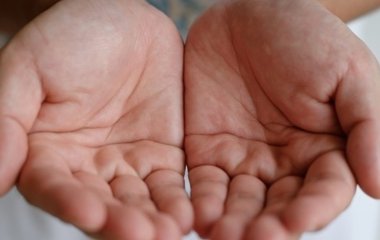 Названий спосіб визначити наявність проблем із печінкою за кольором долонь