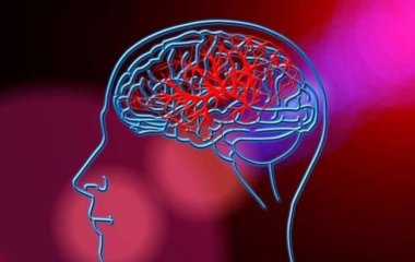 Ученые назвали пять простых привычек, которые снизят риск возникновения инсульта