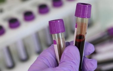Як за аналізами крові після травми можна передбачити інвалідність та смерть