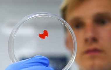 Лікар розповіла про небезпечні ускладнення хвороби щитовидної залози.