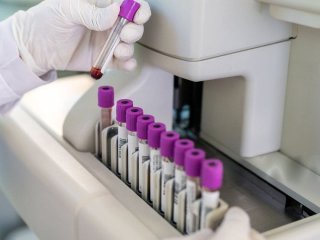 Хворобу Альцгеймера можна передбачити за десятиліття до симптомів — новий винахід