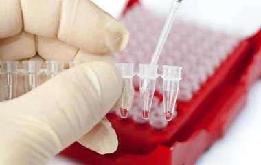 Виявляє хворобу до перших симптомів: у Британії розробили новий метод діагностики раку