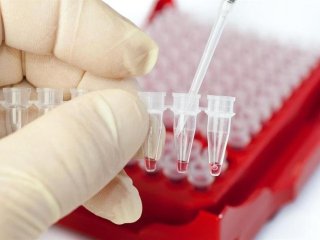 Виявляє хворобу до перших симптомів: у Британії розробили новий метод діагностики раку