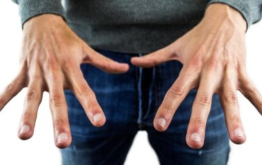 Які зміни нігтів можуть вказувати на хвороби — пояснення лікаря