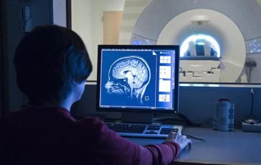 Вчені встановили фактори передчасного старіння мозку