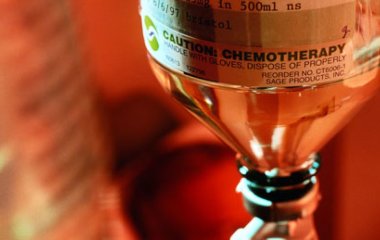 Пацієнту з онкологією призначили 8 років хіміотерапії: до чого це призвело
