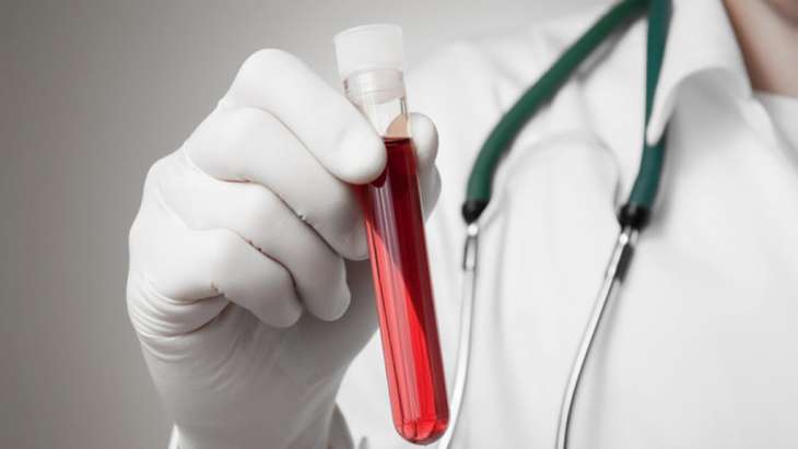 Врачи назвали пять натуральных разжижителей крови, которые спасают от инсульта и тромбов