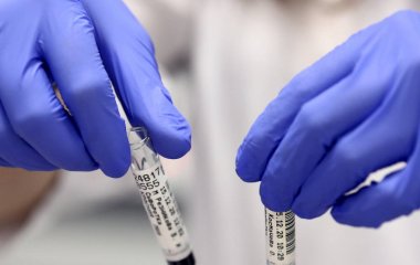 Лікар назвав захворювання, при якому слід ховати ноги від сонця
