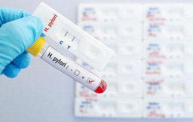 Що може викликати гастрит та чи можуть його провокувати продукти