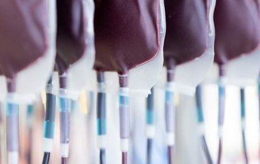 Вчені запропонували лікувати хворобу Альцгеймера переливанням крові