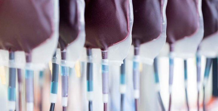 Вчені запропонували лікувати хворобу Альцгеймера переливанням крові