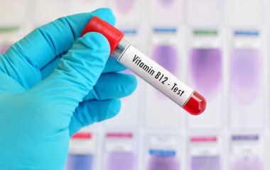 Симптоми дефіциту вітаміну B12: лікар попереджає про «жовто-синю колірну сліпоту»