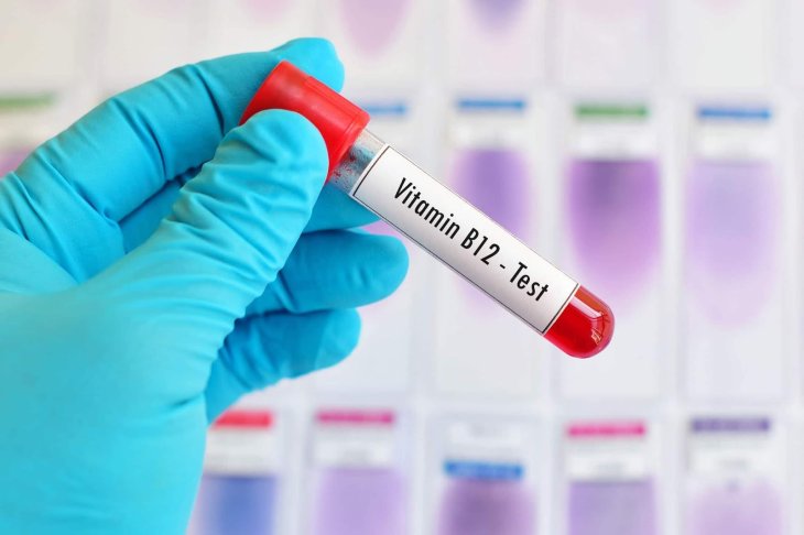 Симптоми дефіциту вітаміну B12: лікар попереджає про «жовто-синю колірну сліпоту»