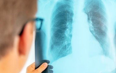 Лікарі попередили про непомітні симптоми раку легенів